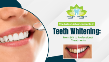 The Latest Advancements in Teeth Whitening: From DIY to Professional  Treatments