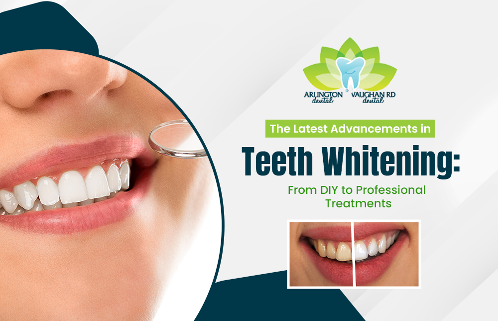 The Latest Advancements in Teeth Whitening: From DIY to Professional  Treatments