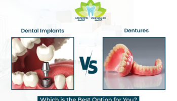 Dental Implants vs. Dentures: Which is the Best Option for You?